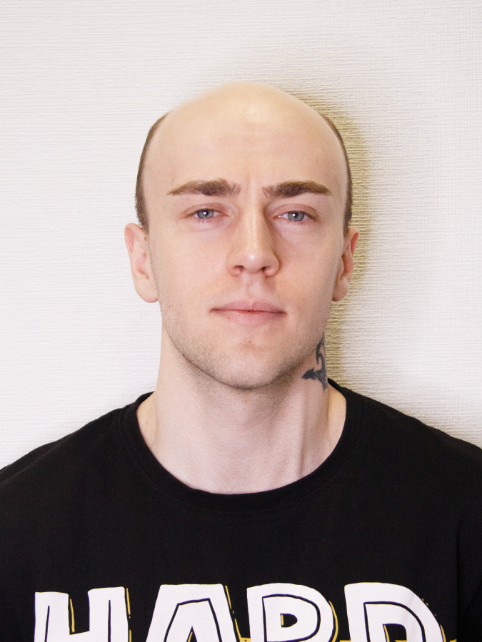 Before Hair System